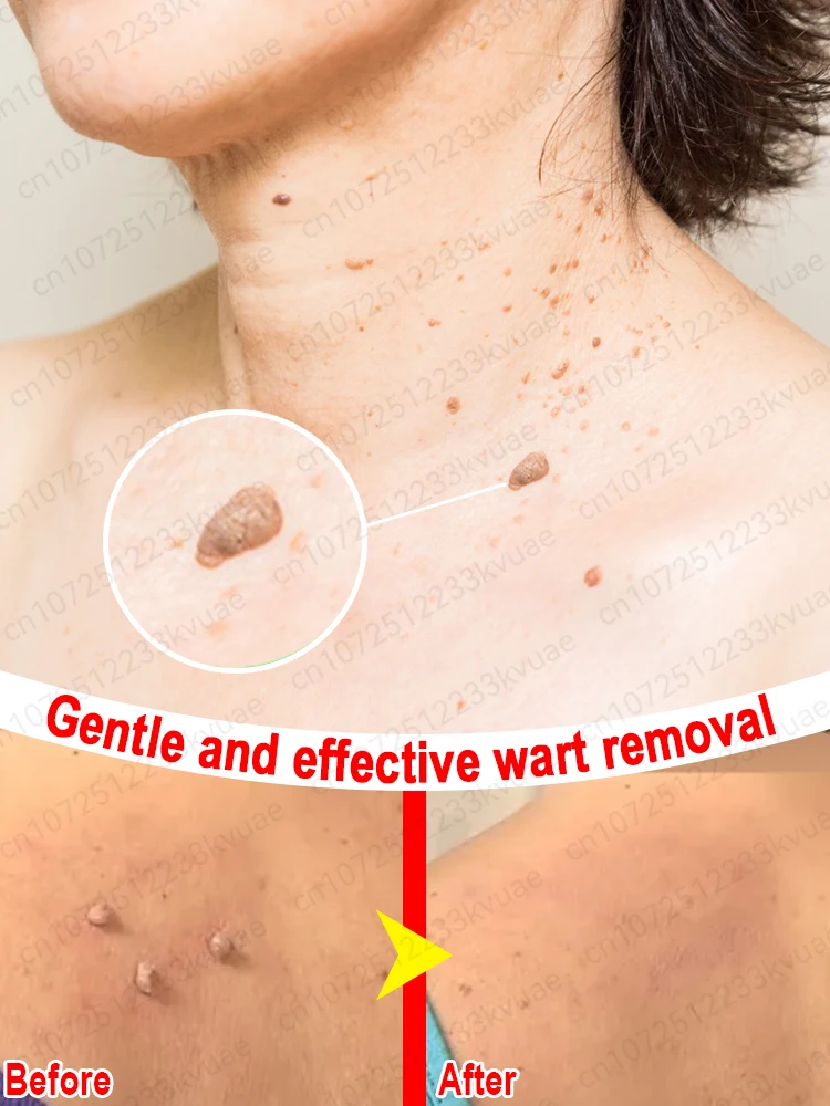 

Mᴀᴋᴇ ᴛʜᴇᴍ ᴅɪsᴀᴘᴘᴇᴀʀ ᴀɴᴅ ᴇɴᴊᴏʏ ʙᴇᴀᴜᴛɪғᴜʟ ᴀɴᴅ ᴄᴏᴍғᴏʀᴛᴀʙʟᴇ sᴋɪɴ vvvvvvvvvv