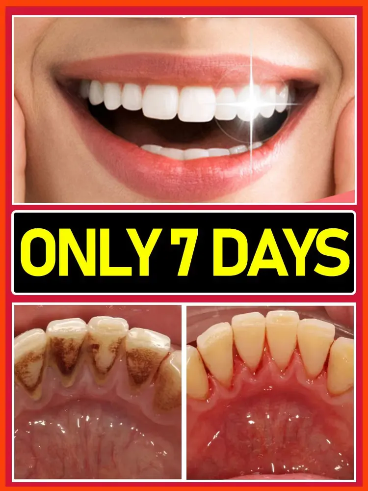 

Solve all dental problem tooth decay
