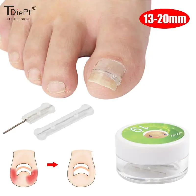 10 pc/box ferramenta de correção de unhas encravadas toe tratamento de unhas adesivo de remendo elástico alisamento clipe cinta pedicure ferramenta