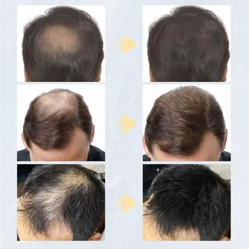 100G Serat Rambut Keratin Bubuk Serat Penumbuh Rambut Instan Kantong Isi Ulang Serat Penebal Pertumbuhan Rambut Produk Perawatan Ekstensi Botak