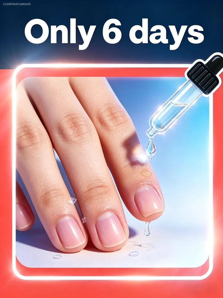 

A few drops daily for healthy, shiny new nails. ᴬⁿᵗⁱᵇᵃᶜᵗᵉʳⁱᵃˡ ˢᵒˡᵘᵗⁱᵒⁿ ᶠᵒʳ ᵗʳᵉᵃᵗⁱⁿᵍ ᵒⁿʸᶜʰᵒᵐʸᶜᵒˢⁱˢ.