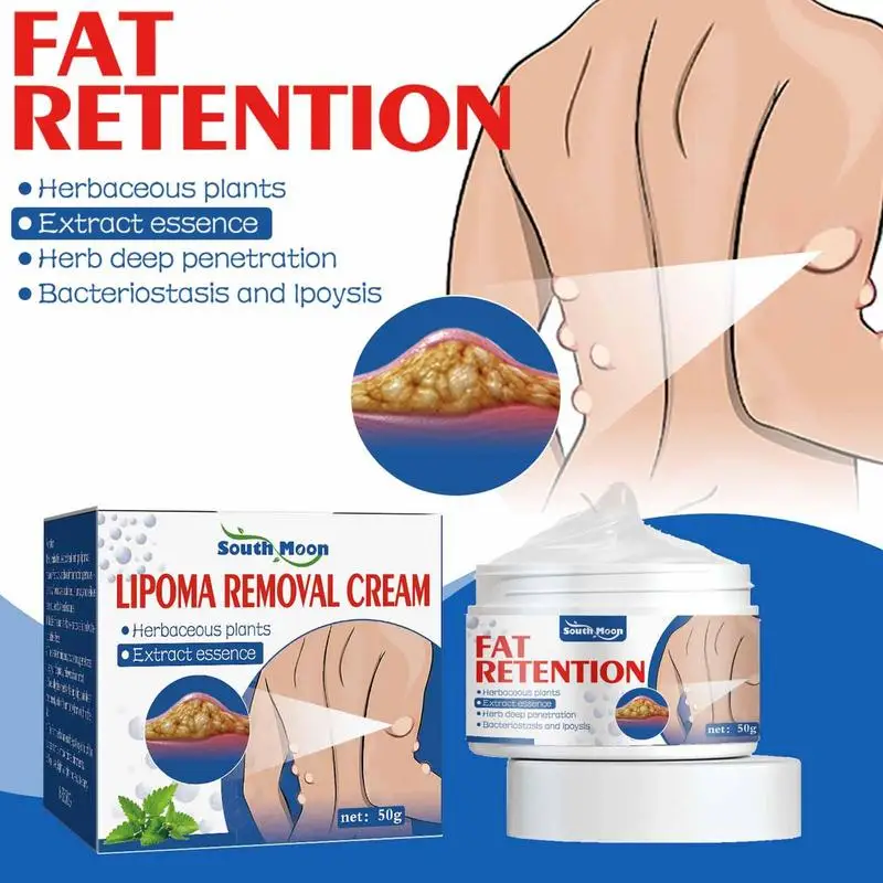 50g Lipoma Removal Cream The Whole Body Multiple Subcutaneous Conditioning Cream Eliminate Paste Fiber Paste Skin Care