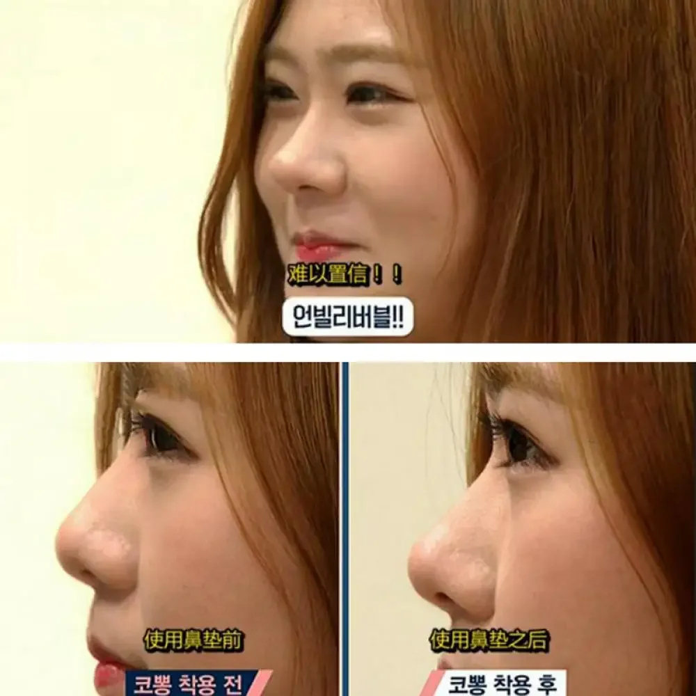 الجمال مشبك الأنف مصحح جهاز تدليك الأنف حتى رفع تشكيل كليب المقص المشكل جسر استقامة لا ألم 3 الحجم #5