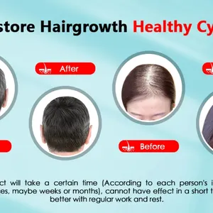 LED kırmızı ışık saç büyüme, bir kap, bir terapi, ve Anti-saç dökülmesi, anksiyete, stres giderici, şapka, ve baş ağrısı, kafa derisi, rahatlatıcı masaj kask Saç terapisinde cihazın 6 büyük satışı-no. 4