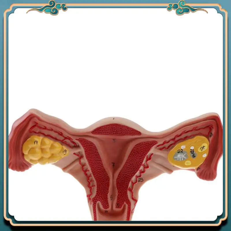 ABJG-2X 1:1 Human Female Uterus Ovary Fallopian Tubes Model Anatomical Human Anatomy Model Teaching Tools