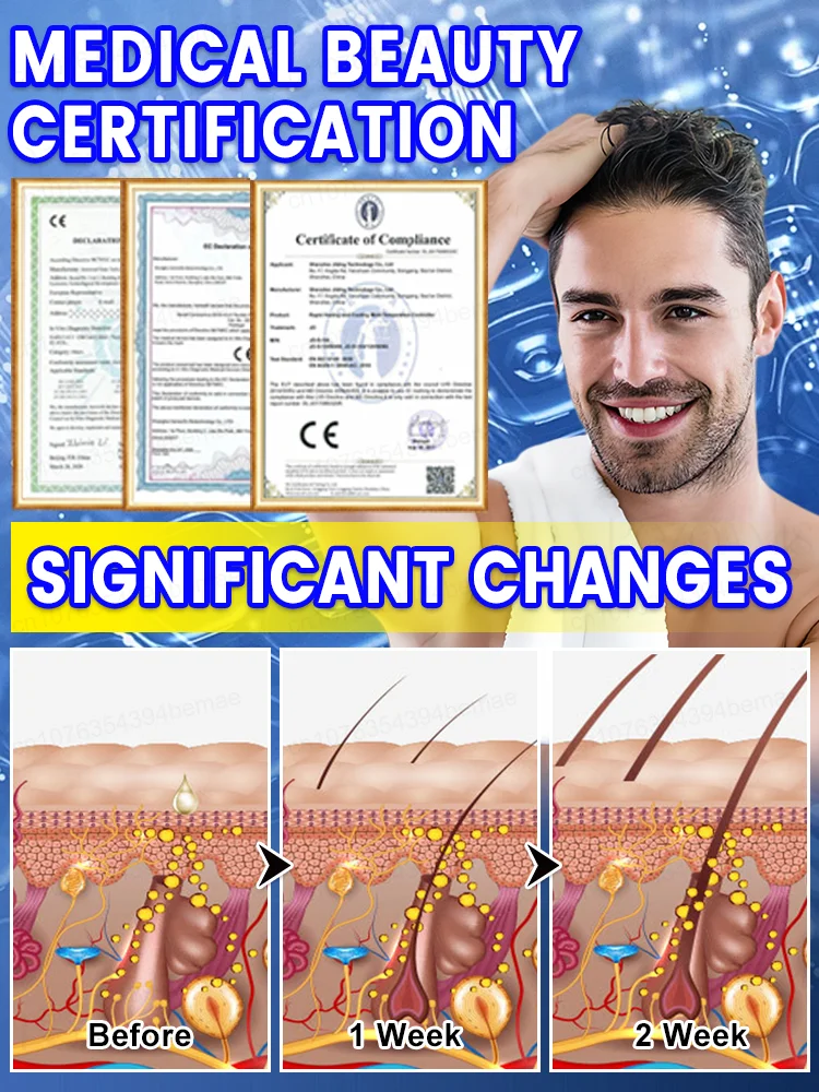 Worried about hair loss? New hair growth spray for thicker hair