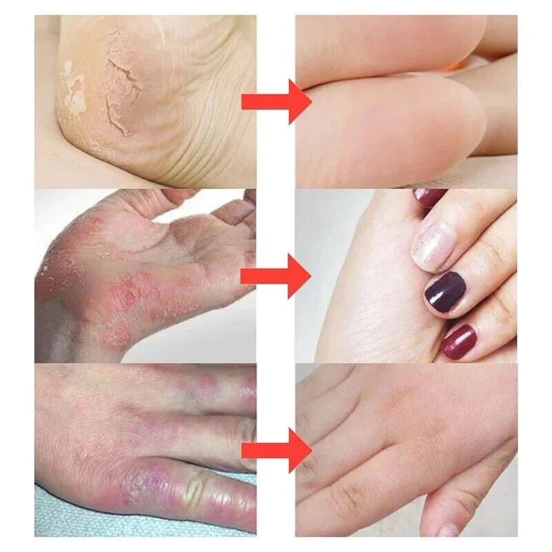 Traditional Chinese Clam Oil Anti Drying Cracked Repair Hand Cream Foot Heel Moisturising Ointment Removal Feet Dead Skin Care