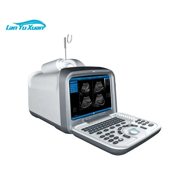 Innovative Ergonomic Design Medical Ultrasound Scanner Machine Clinic for Pregnant Women