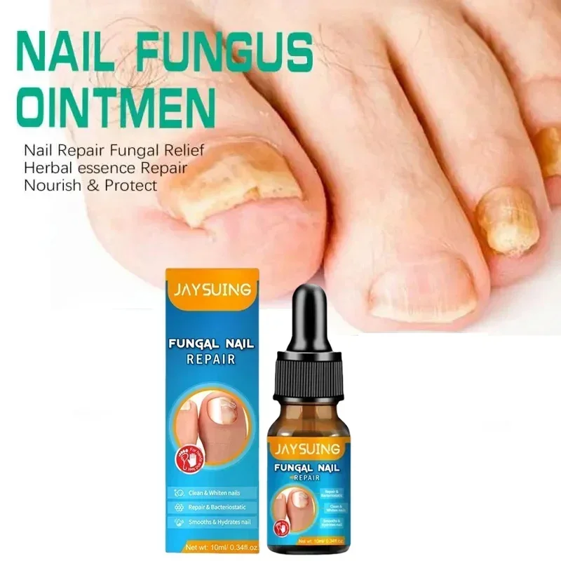 Extra Strong Nail Fungus Treatment Serum Essence oil Feet Nails Repair Care Essence Cream Anti Infection Toe Fungal Removal 4185