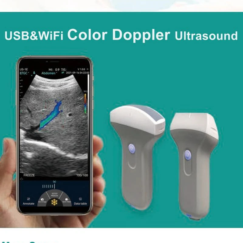 

Wireless USB Color Doppler Ultrasound Probe for Abdomen Cardiac Kidney Vascular Handheld Convex Linear Array