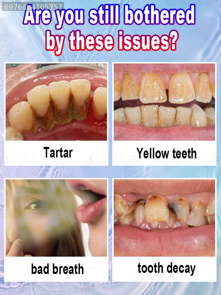 Hydroxyapatite Toothpaste Effectively Combats Tartar, Promotes Enamel Re-strengthening, Deeply Removes Plaque, Protects Gums, and Addresses Issues Such as Swollen Gums and Bad Breath. It Provides Professional Oral Hygiene, Fresh Breath, and Overall Care.