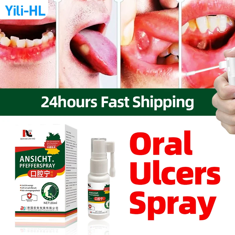 Mouth Ulcer Treatment Spray Oral Ulcers Antibaterial Clean Freshner Canker Sores Relief Medicine German Secret Recipe 20ml