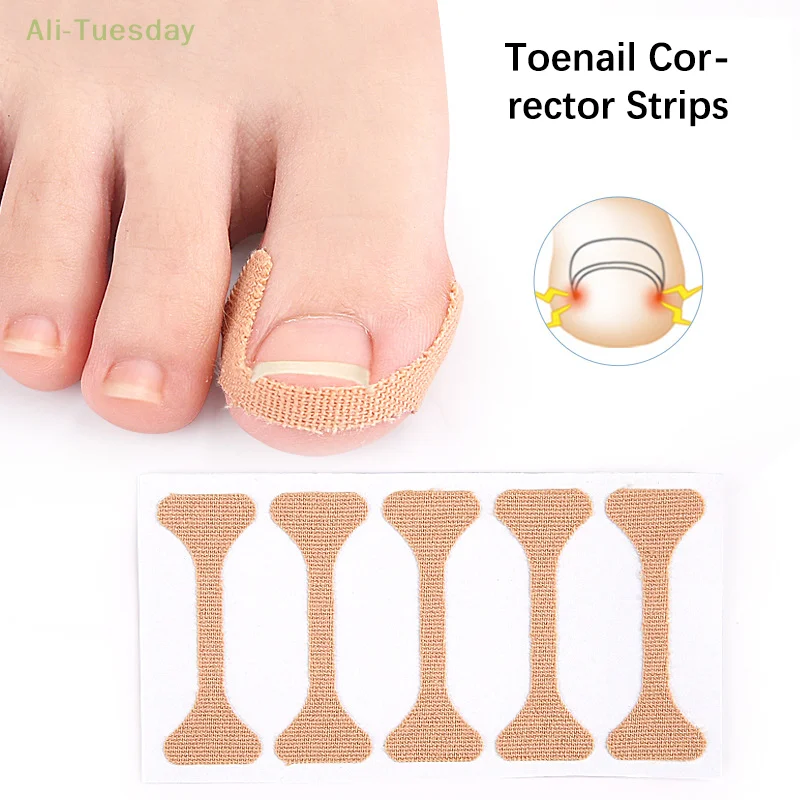 5/15/30 Pcs Ingrown Paronychia Toenail Corrector Strips Anti Fungal Nail Correction Stickers Anti Infection Nail Treatment Patch