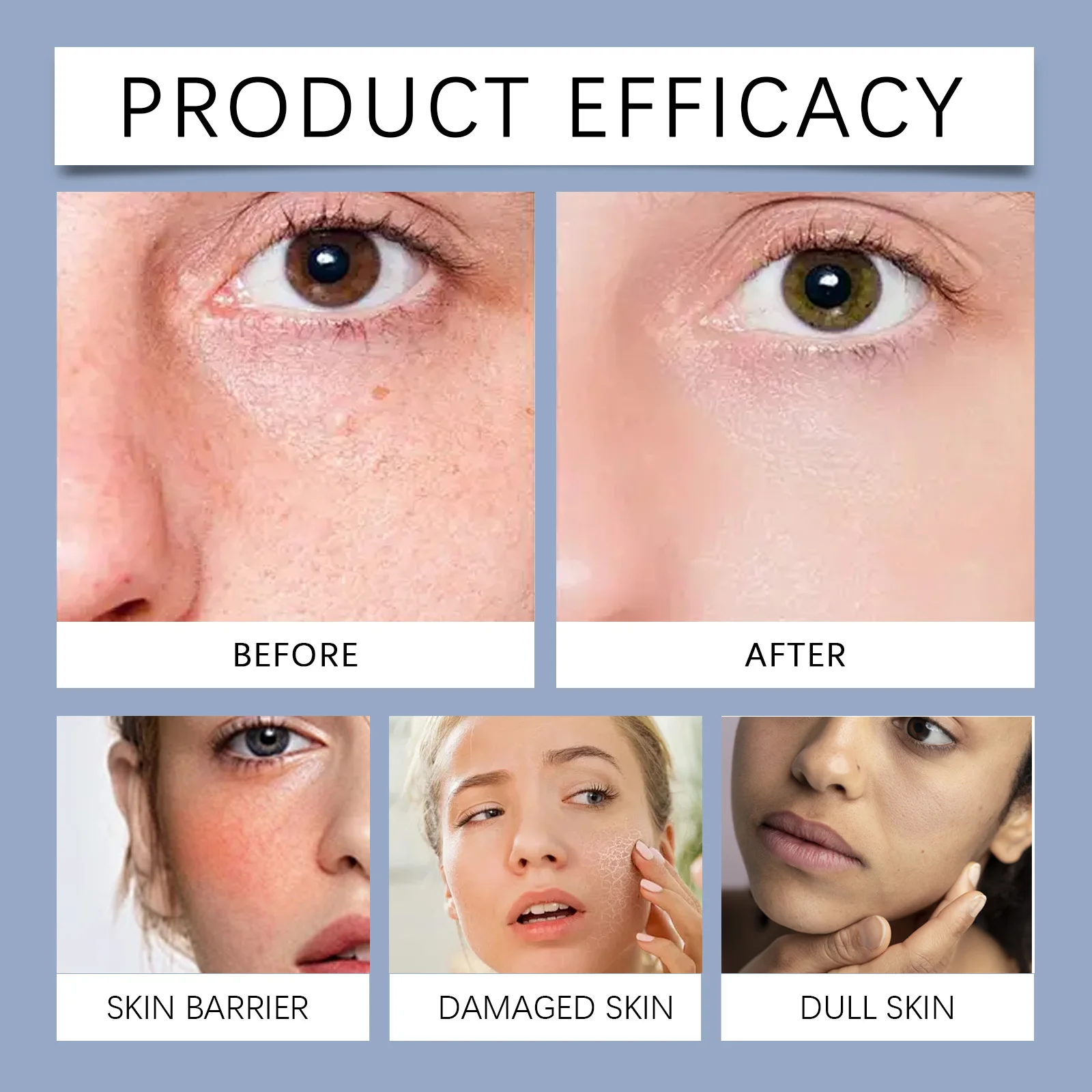 Crema idratante West&Month, acido ialuronico, olio di mandorle dolci, estratto di aloe vera, viso, effetto idratante e radiante, Net Wei