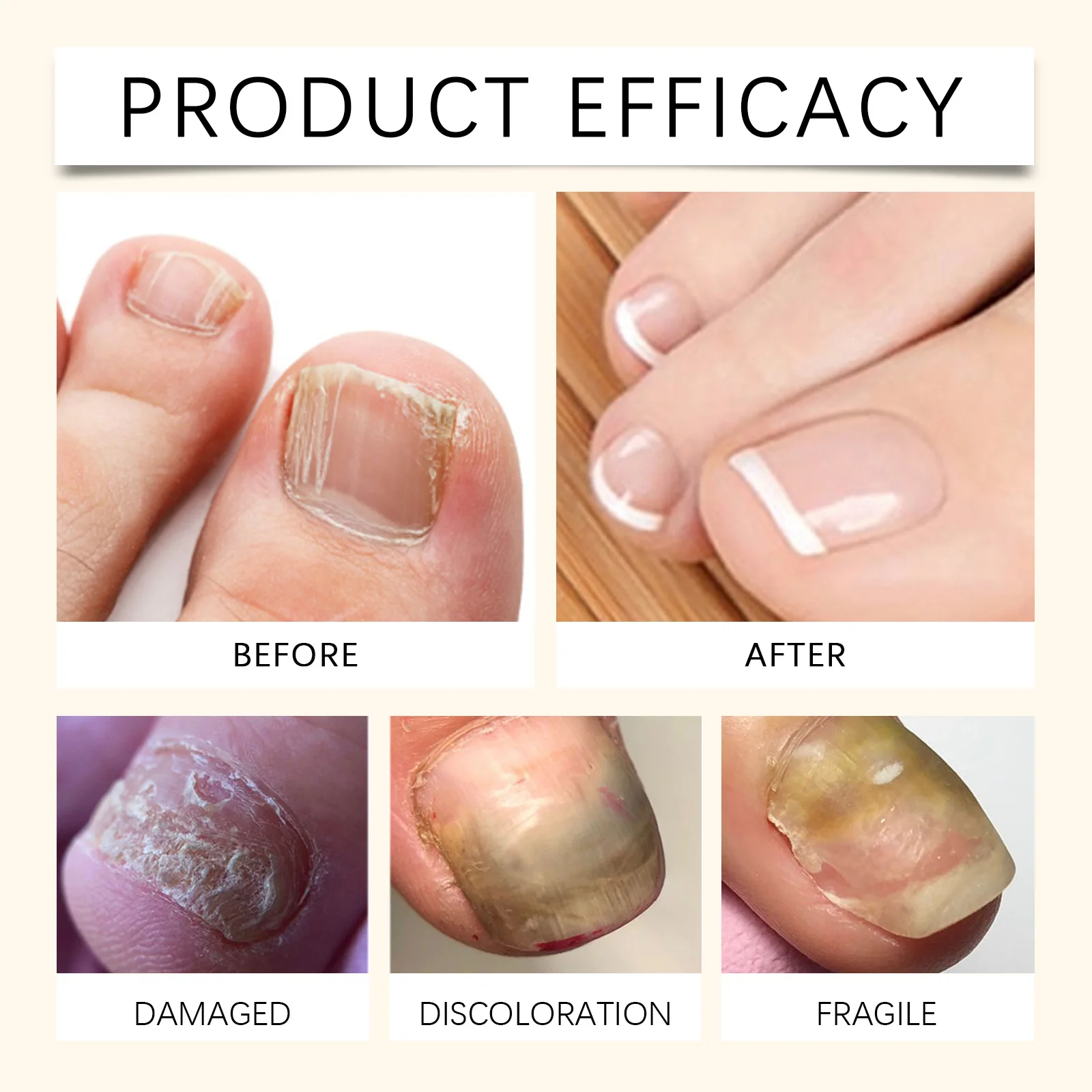 OUHOE Ginger Nail Care Serum Deep Nourishment Maintains Comfort Prevents Cracking Gentle Formula For Daily Nail Care