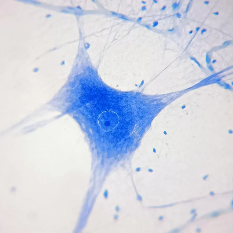 Imagem -04 - Conjunto de 100 Lâminas de Histologia Típica Preparadas para Microscópios para Ensino de Educação de Estudo Médico