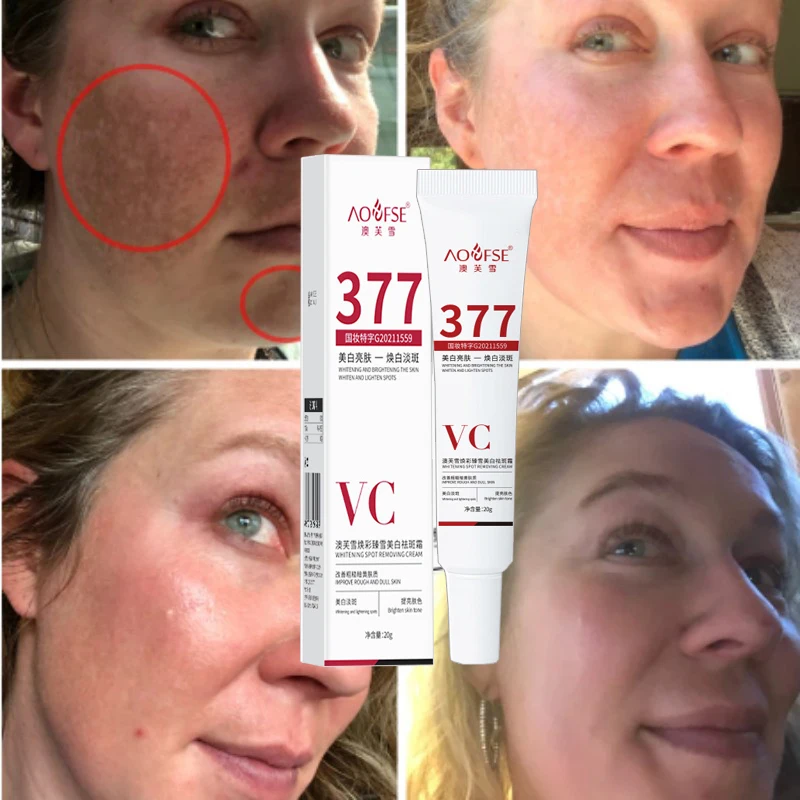 Gezicht Verhelderende Crème Niacinamide Verminderen Chloasma Melasma Lichter Donkere Huid Serum Vervagen Fijne Lijntjes Zorg Fleuren Crème Nieuwe