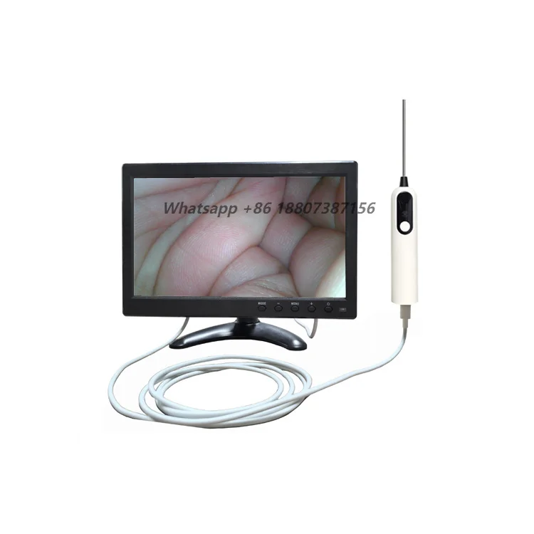Veterinary endoscope high definition image processor factory direct sales disposable ureteroscope