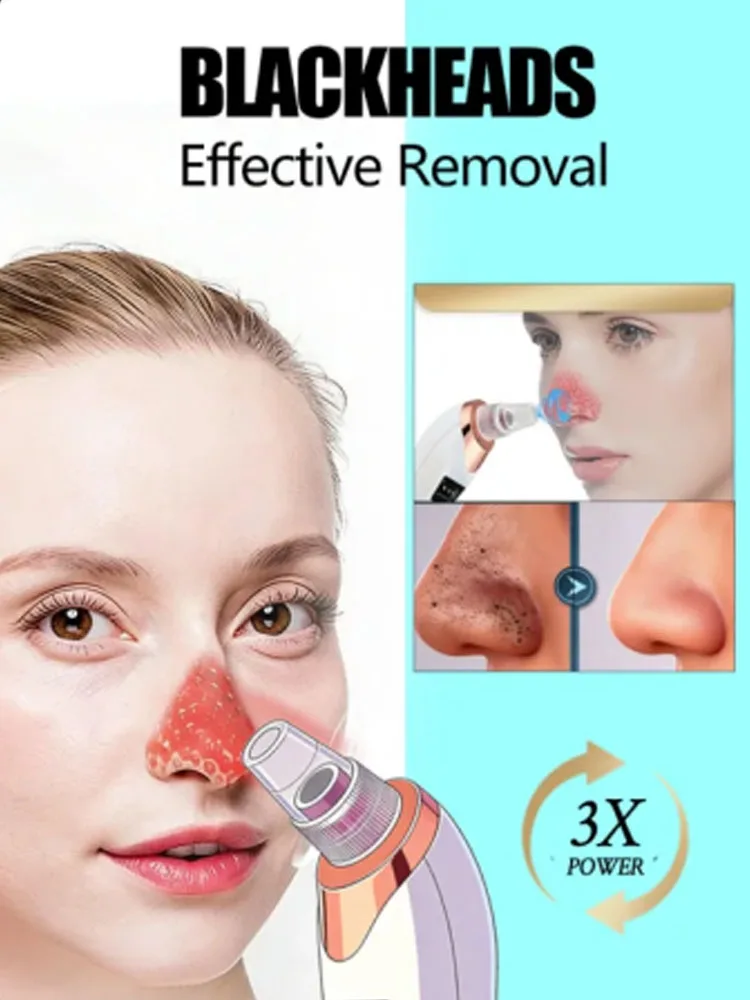 

Face Cleansing Beauty Machine Dead Skin Remover Face Vacuum Blackhead Removal Skin In Stock Fast Drop Shipping