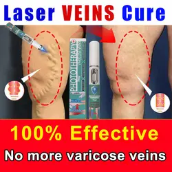 Veine laser