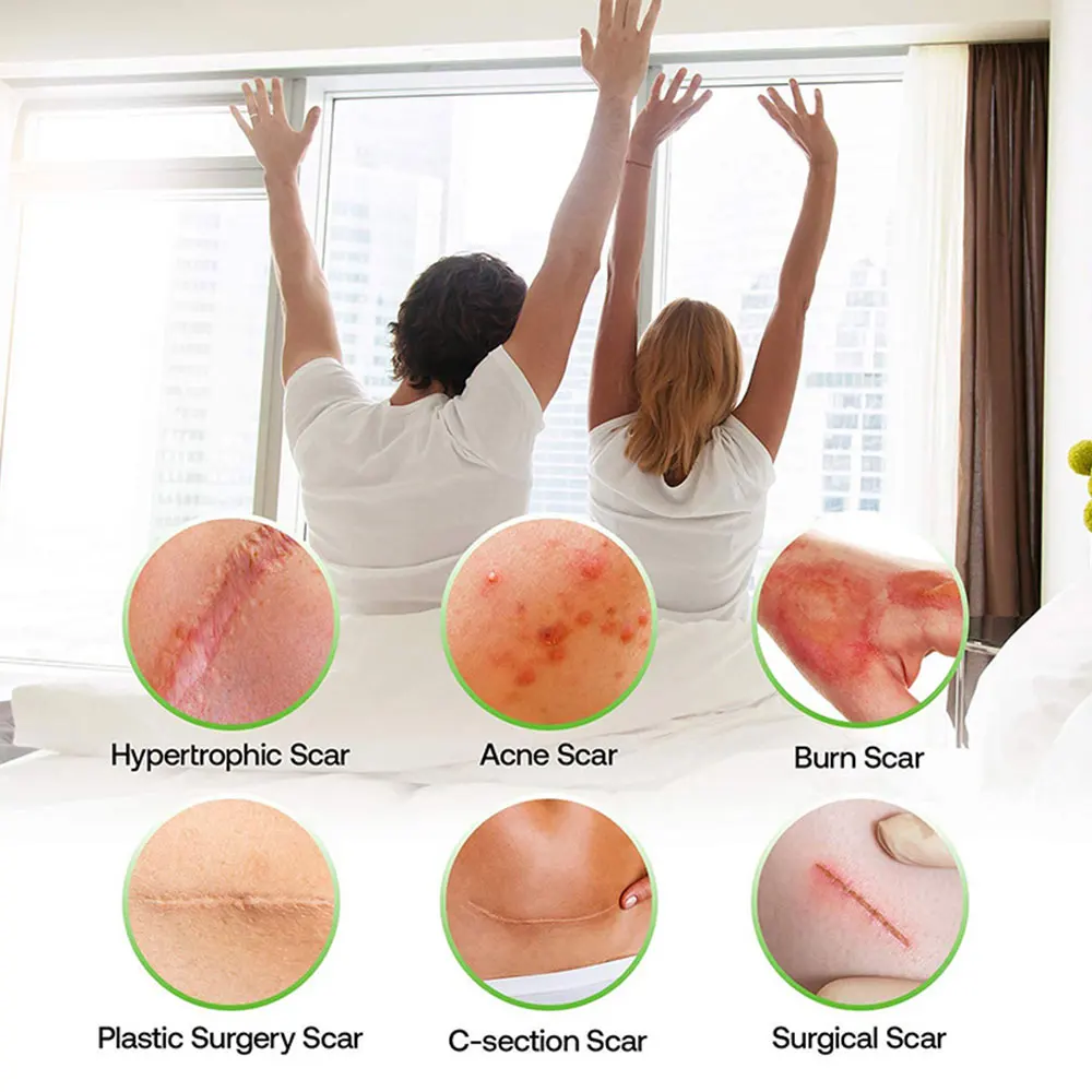 4 سنتيمتر * 50 سنتيمتر ندبة ورقة إزالة قطاع الطفل الأذن مصحح هلام السيليكون ندبة التصحيح قطاع لحب الشباب كيلويد جراحة حرق العلاج #5