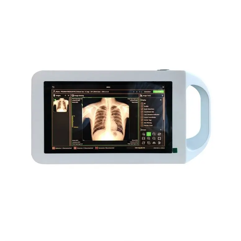 Digitale DR X Ray Machine Handheld X Ray-camera voor voet-elektrische stroombron