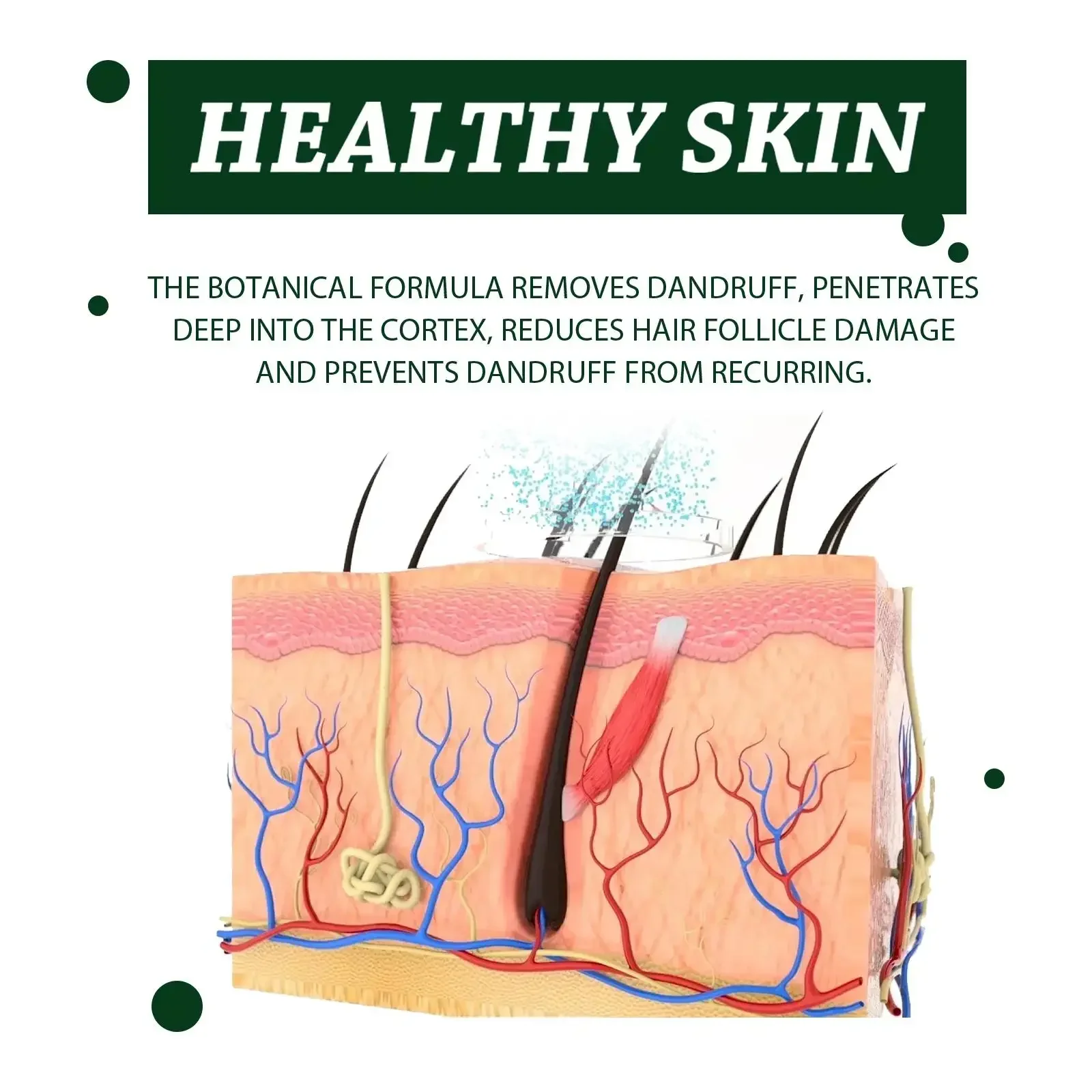 شامبو علاجي علاج مضاد للقشرة حكة فروة الرأس الدهنية شامبو عشبي للعناية بالبشرة للشعر 100 مللي شامبون للنساء #4
