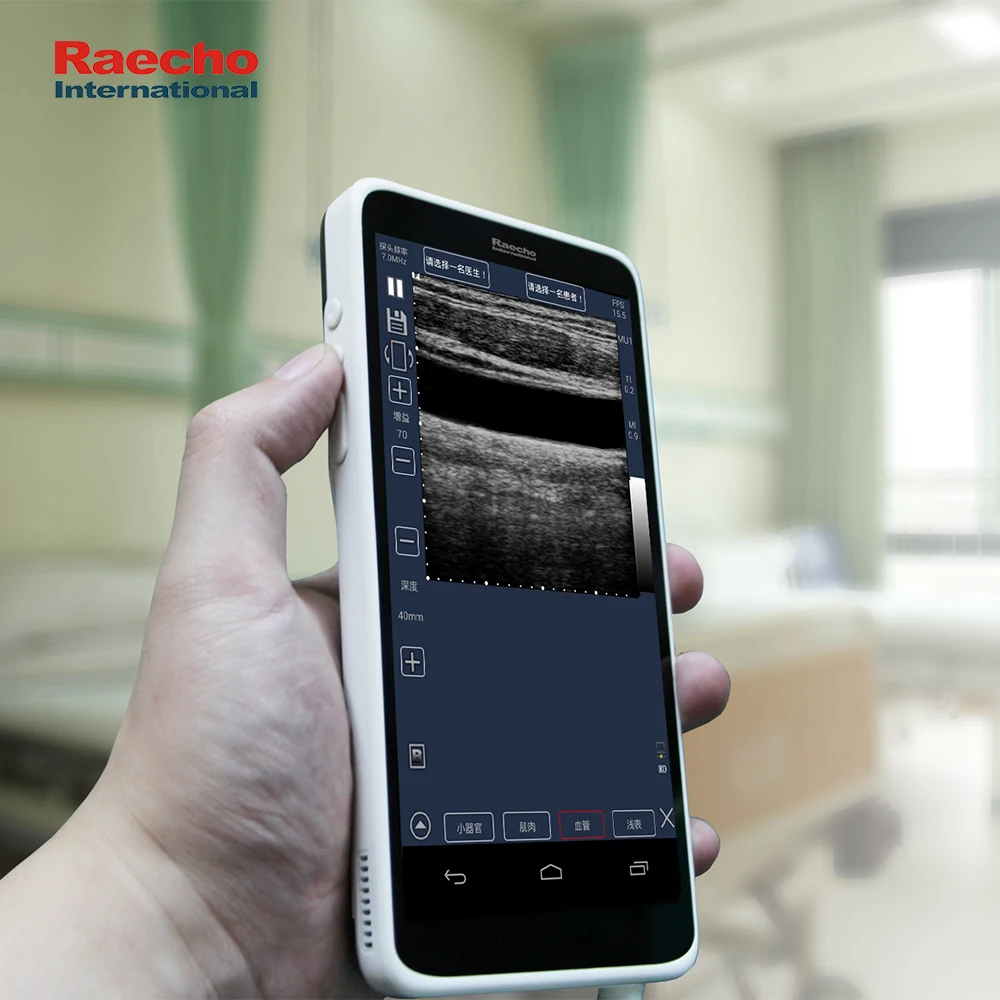 Mini Handheld Wireless Scanner Ultrasound with Good Price