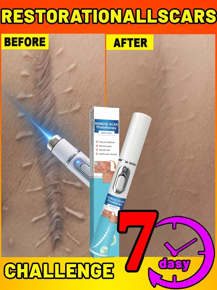 Laser not leave scars Remove scar