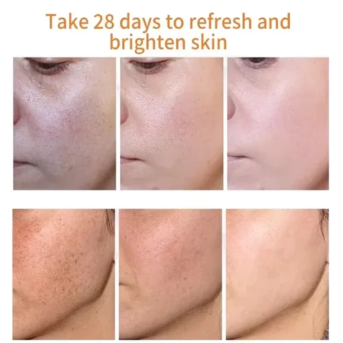 Imagen 2 del producto Nicotinamida blanqueamiento pecas suero facial eliminador de manchas oscuras productos eliminación Melasma melanina hidratante iluminar el cuidado de la piel