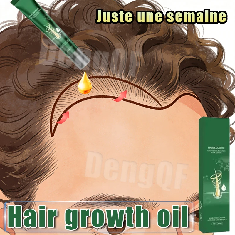 

Hair Growth Oil Fast Growing Anti-Hair Loss Repair Hereditary Anti Postpartum Seborrheic Hair Loss Products Scalp Enhancement