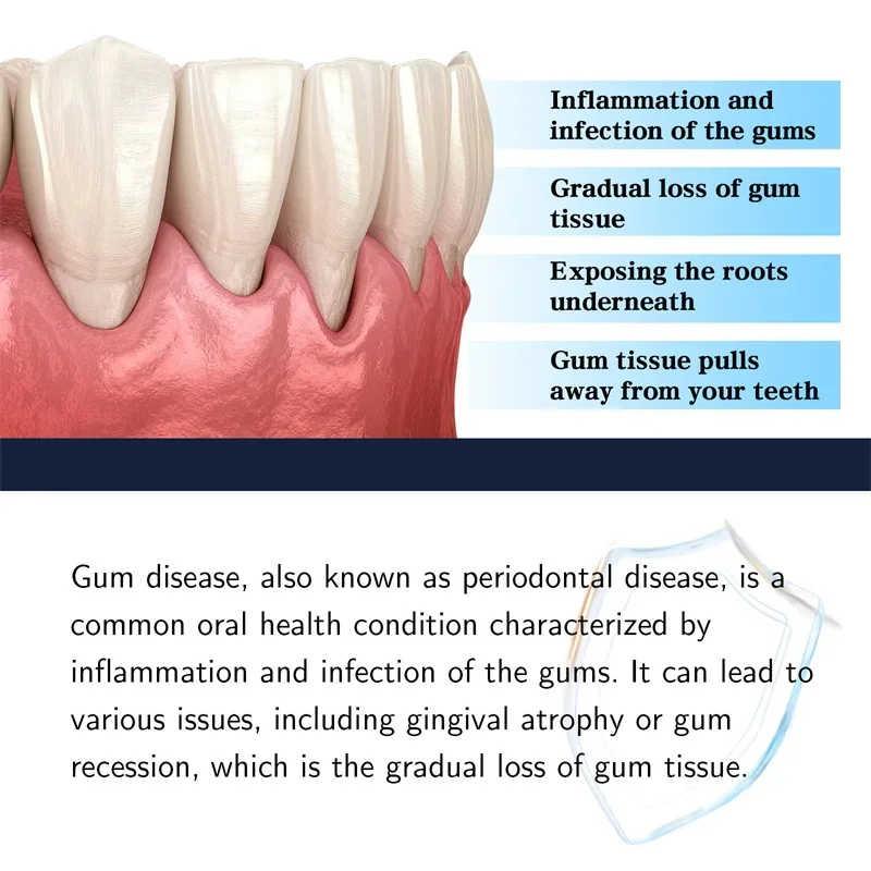 إصلاح مصل اللثة بشكل فعال تخفيف حساسية الأسنان تسوس الأسنان تنظيف الأسنان معجون الأسنان تخفيف قطرات تلف الأسنان #3