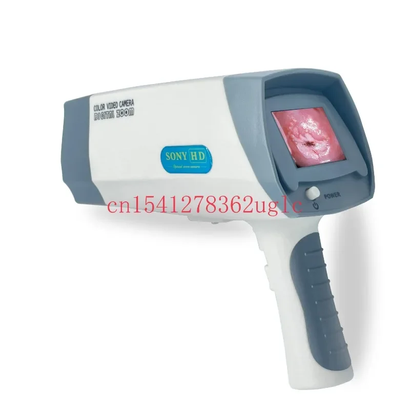 Best Selling Portable Gynecology Endoscope Colposcope With Digital Display Screen And Software