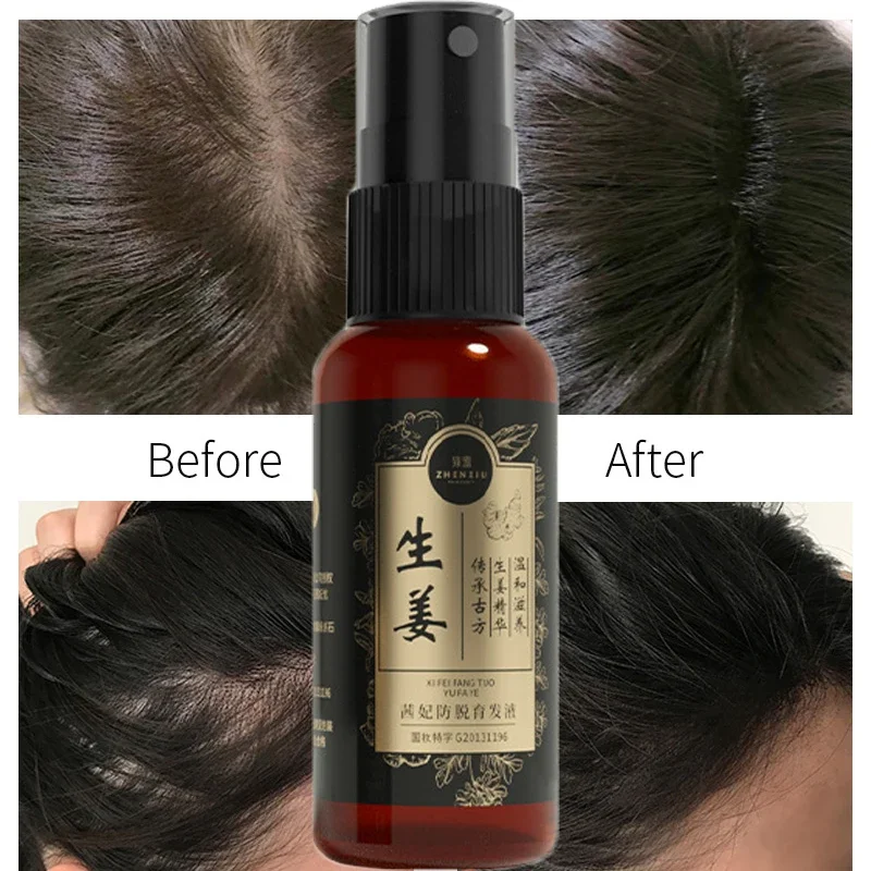 

2 pcs Faster Hair Growth Product Regrowth Serum Oil Natural Ginger Hair Growth Spray Prevent Hair Loss