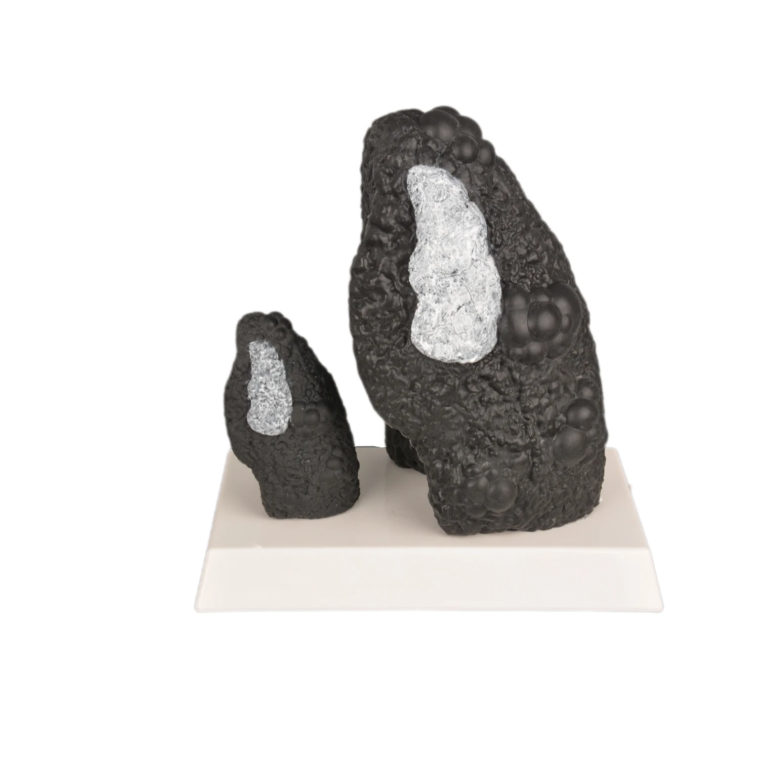 Petit modèle de comparaison Maurice normal et malade