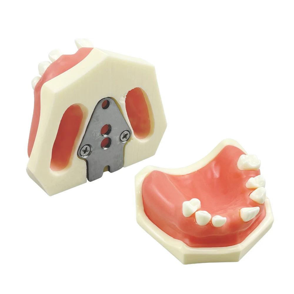 

Модель верхних и нижних челюстей с мягкими деснами для обучения студентов, демонстрационная клиническая модель для имплантации зубов