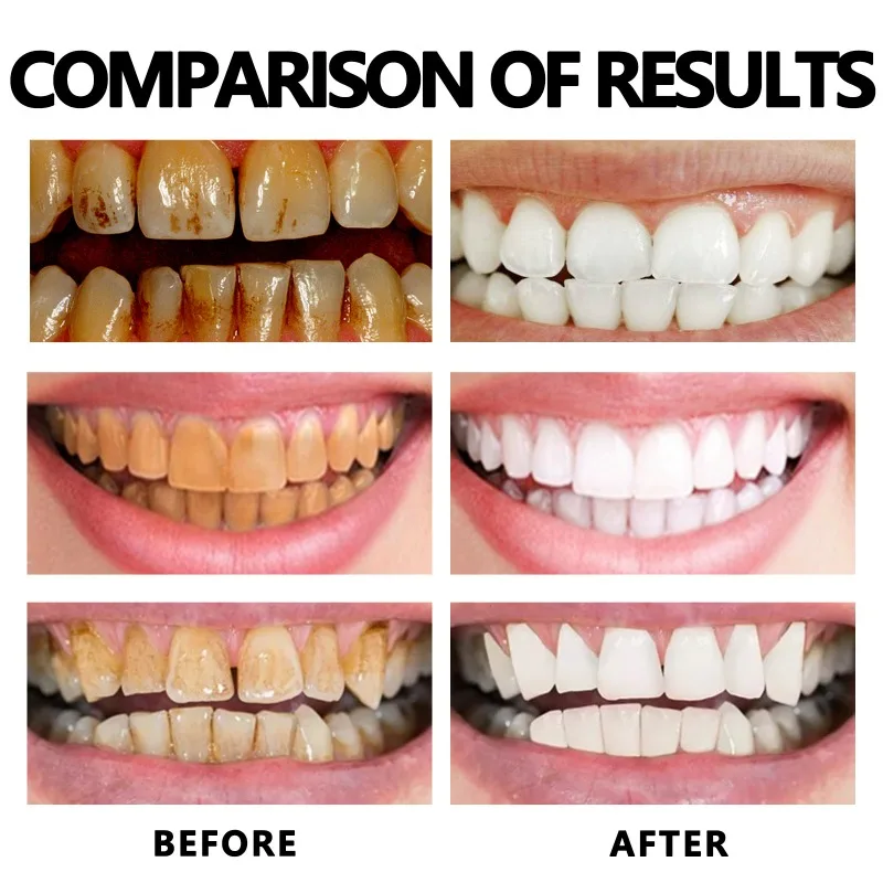 Zahnfleisch-Nachwachstumsschaum, Aufhellung, gelbe Zähne, Zahnpasta, Schaumreinigung, effektives Entfernen von Zahnflecken, Mundreinigungsprodukt