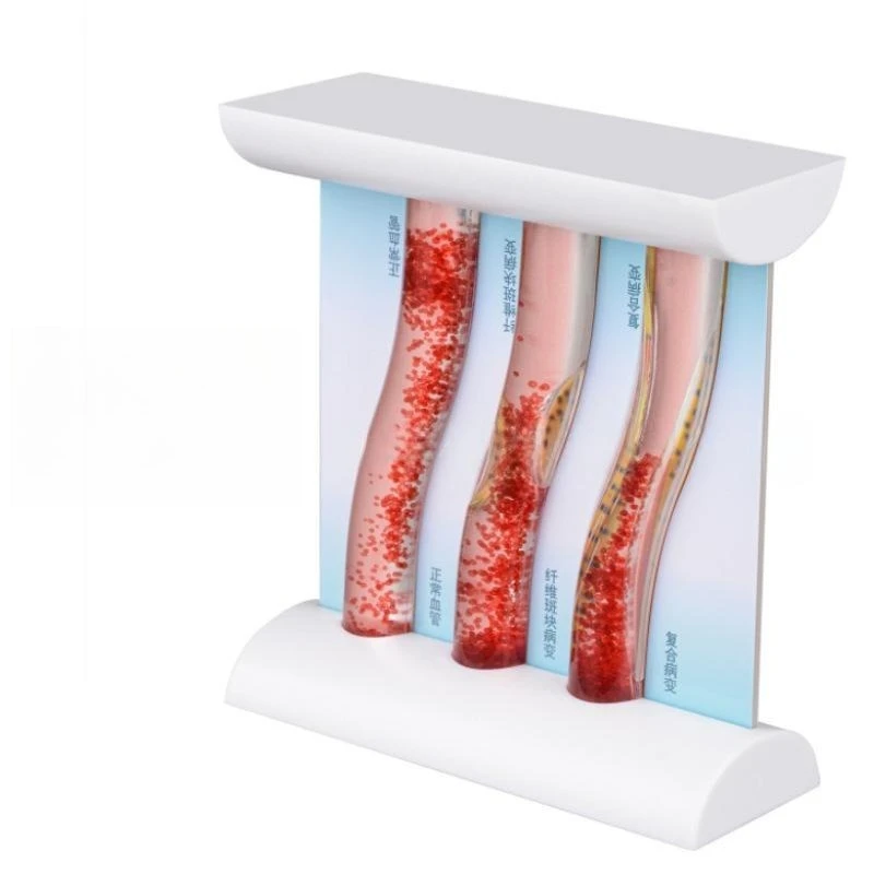 Three-Vessel Vascular Model: Healthy Artery and LDL-Induced Blockage Simulation