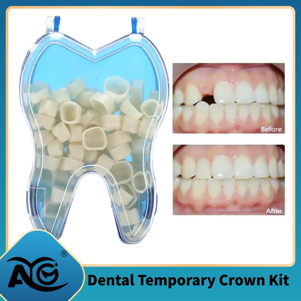 AG 50 Pcs/Box Dental Temporary Crown Kit Anterior Front Molar Posterior Teeth Veneers Dentistry Tooth Whitening Dental Tools