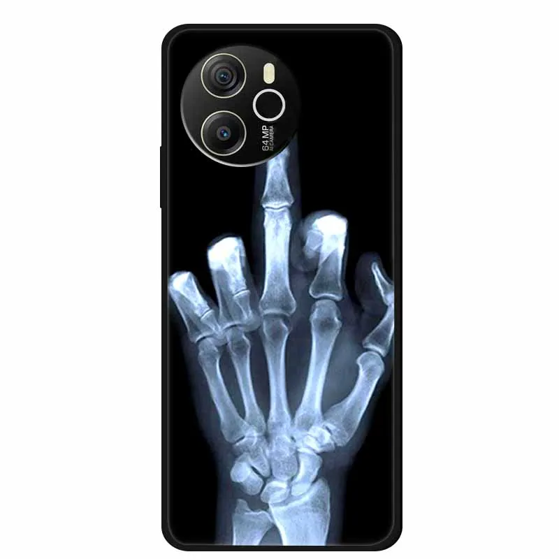 Dla Blackview Shark 8 Etui Shark8 Czarny Silikonowy Miękki Pokrowiec Na Telefon Blackview Shark 8 Pokrowiec 6,78" Coque Funda — zdjęcie 4
