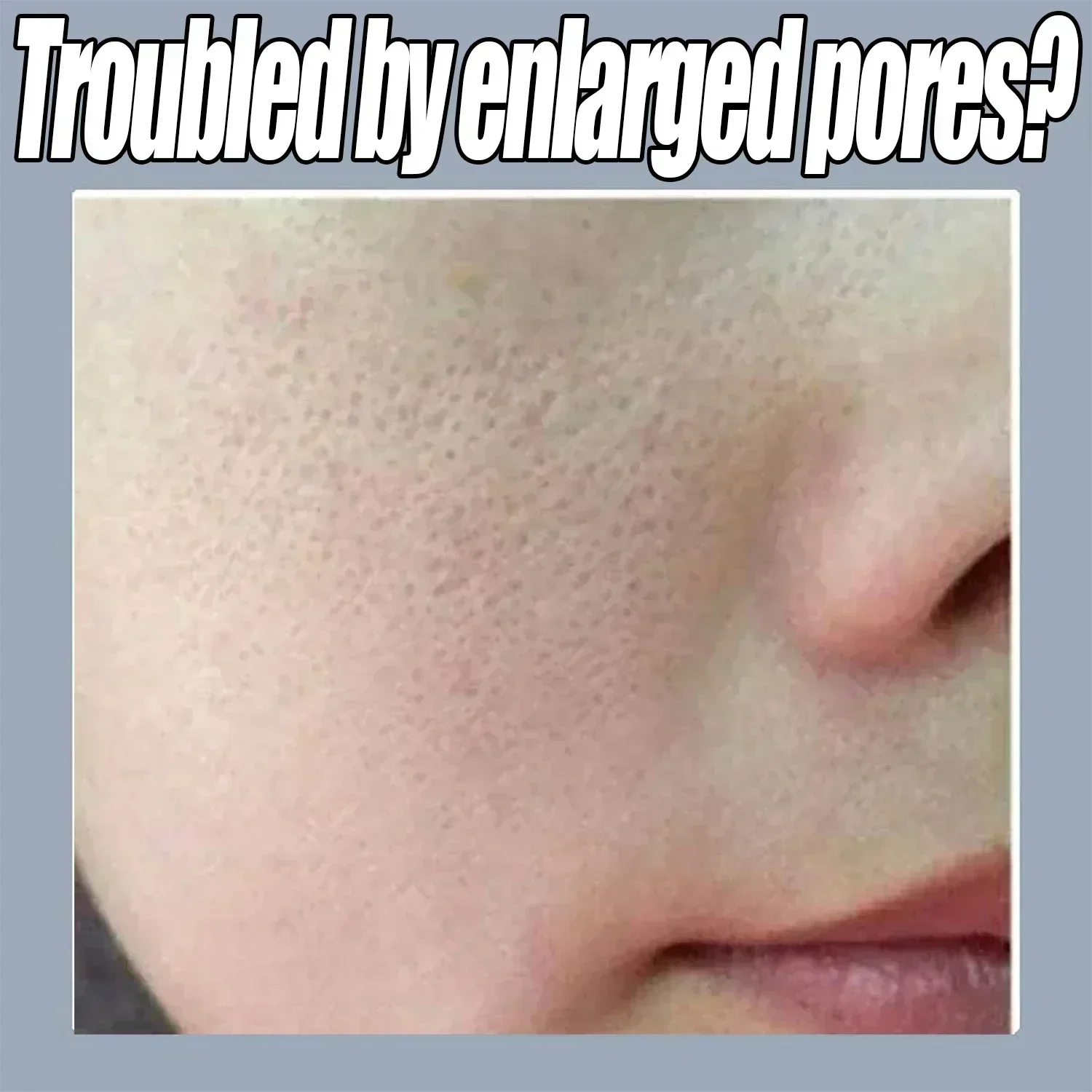 เนื้อผิวหนัง |   Pore Rinning Resurfacing เซรั่มหดตัวรูขุมขนอันทรงพลังเพื่อกระชับและขจัดรูขุมขนขนาดใหญ่บนใบหน้า