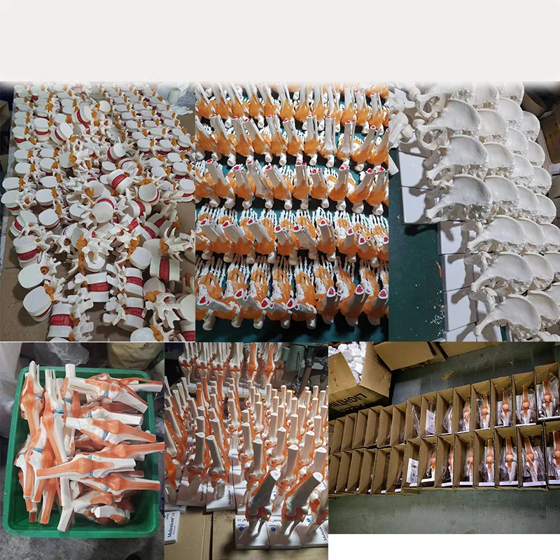 人体解剖学スケルトン脊椎腰椎椎間板ヘルニア椎骨変性マネキン椎間教育モデル