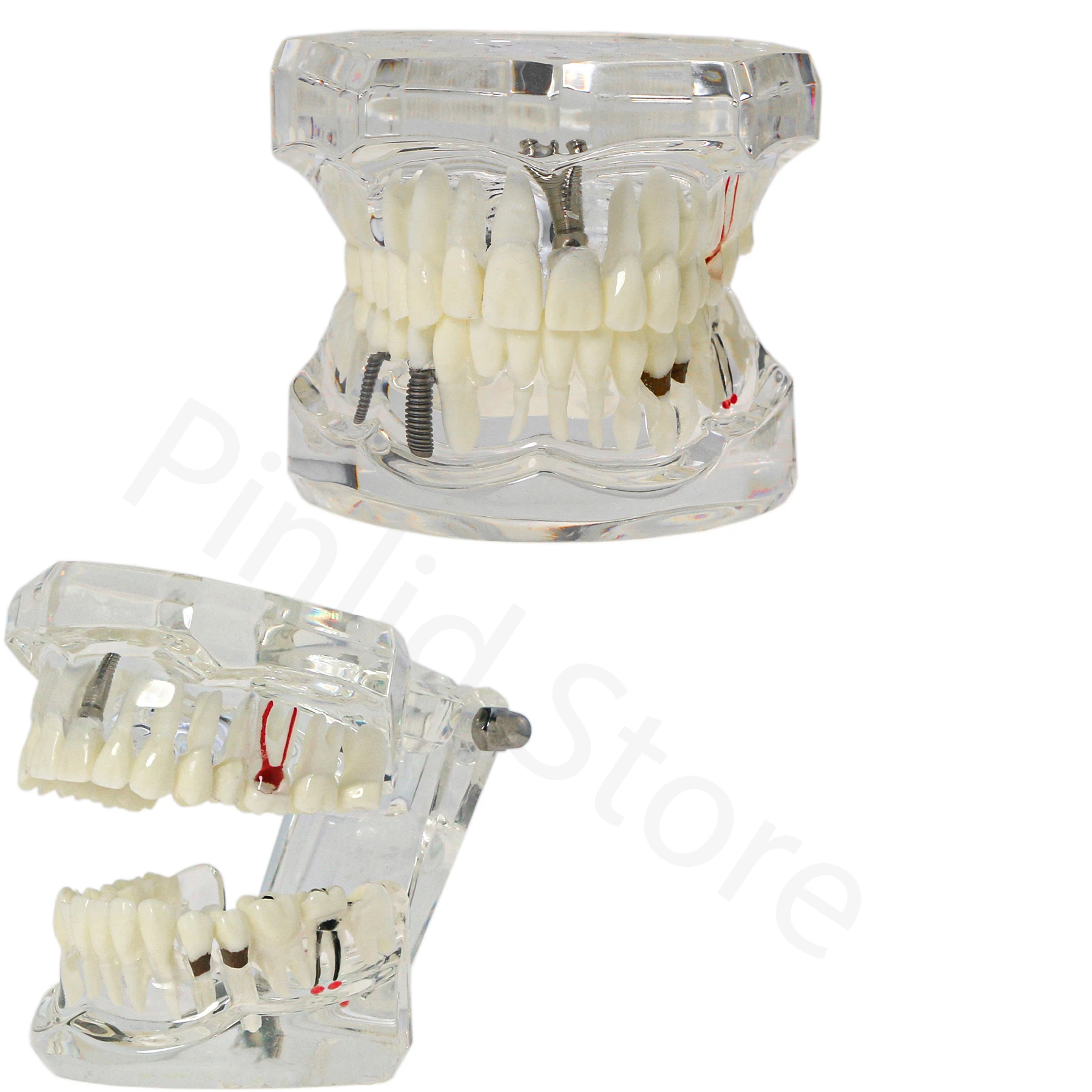 Dental Models Adult Standard Dental Models Practice Training Dental Teaching Learning Demonstration