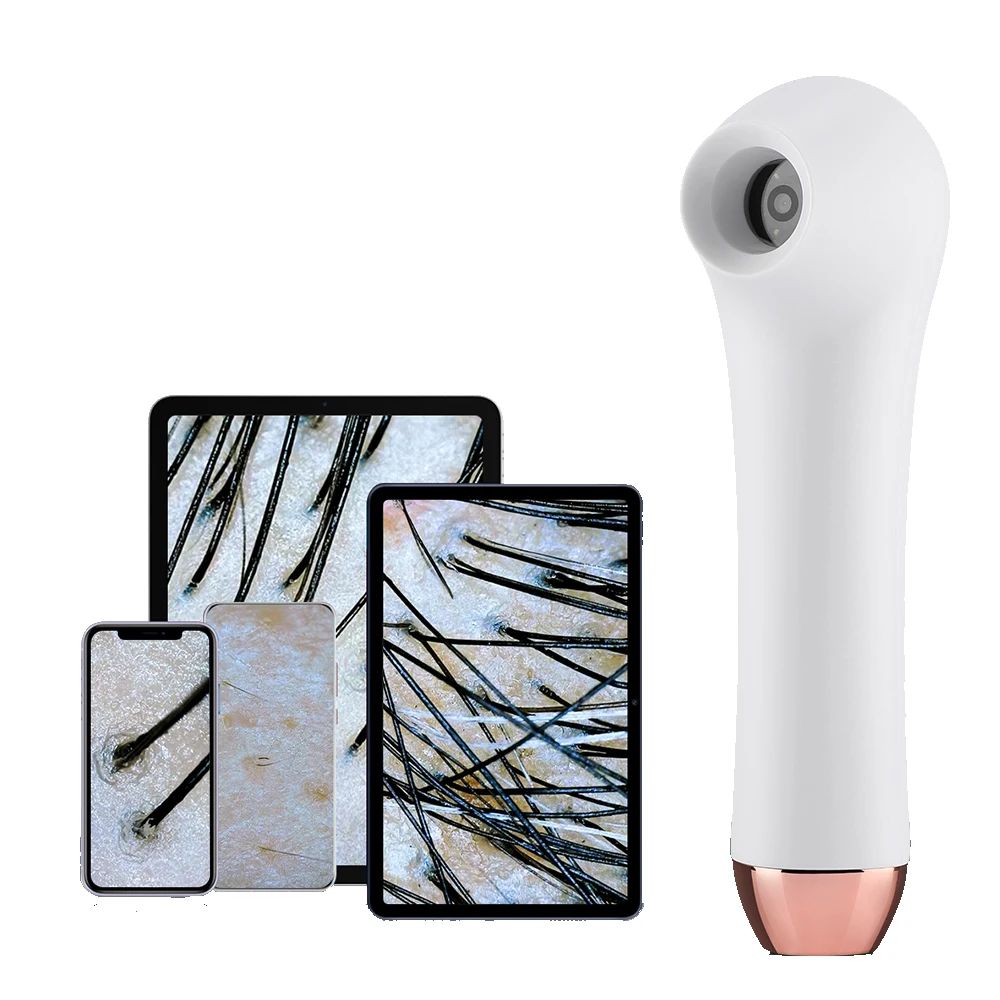 

Skin Analyzer Dermatoscope Scalp/Skin/Hair follicle Scanner Detector Testing Analysis Microscope 1 Million Ultra-clear Blue-ray