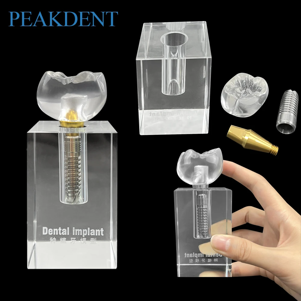

Dental Crystal Implant Teeth Model Clear Implant Denture Model Dental Removable Dentures For Teaching Studying Practice Training