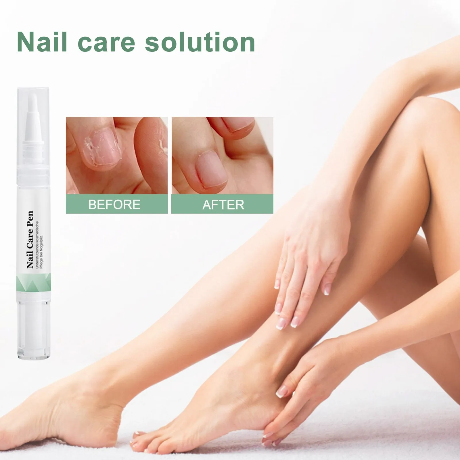 Nail Treatmentpen Nail Cuticle Oil Damaged Nail Pen Nail Strengthening Cuticleswitch Aloevera And Teatree Oil Repairdamaged 3ml