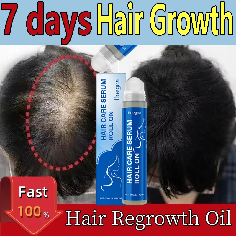 

Rosemary Ball Hair Growth Essence Reduces Hair Loss Thickens Hair Nourishes Scalp Softens Hair Protects Hair Refreshes Hair Care