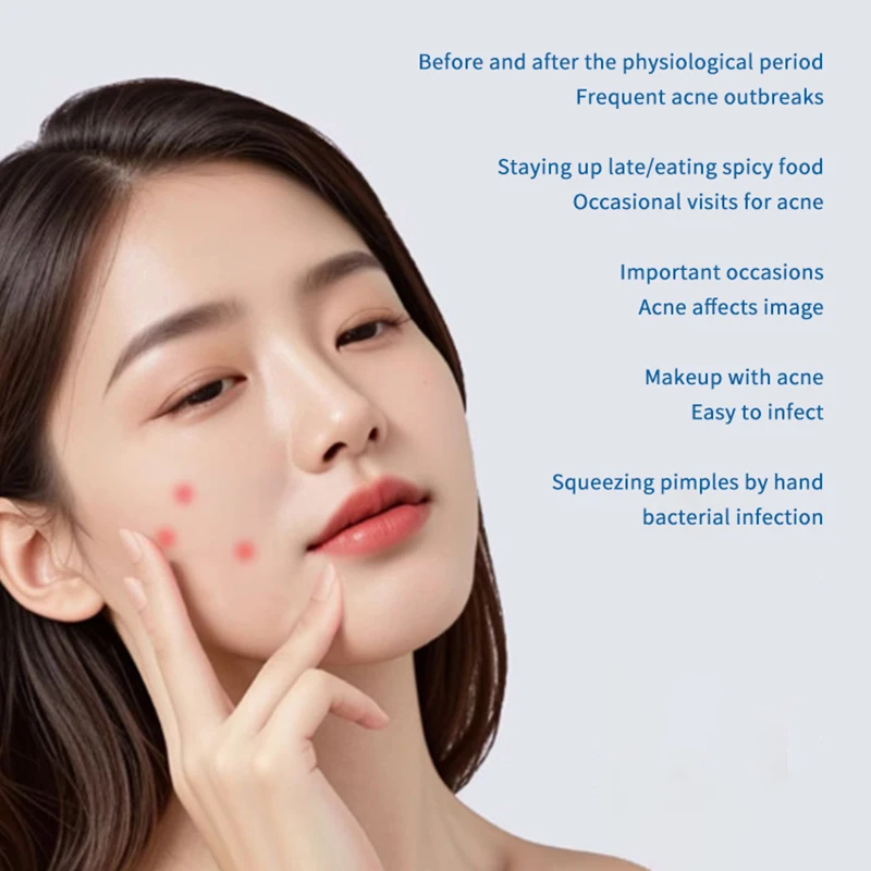 Circle Water Soluble Salicylic Removal Acne Stickers Microneedles Blemish Face Treatment Healing Skin Care