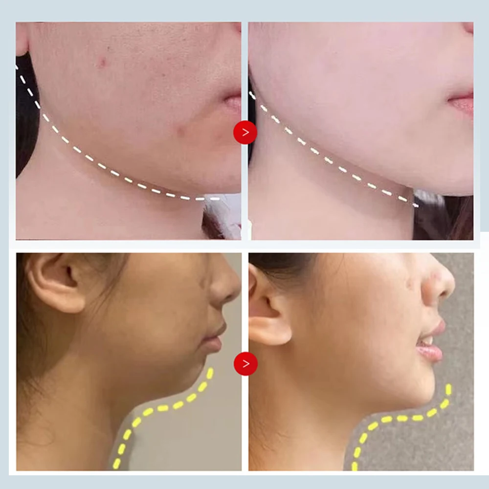 V Shape Face Lift Mask Gel Moisturizing Brightening Anti Wrinkle Chin Cheek V Line Firming Lift Belt Reduce Double Chin Skincare