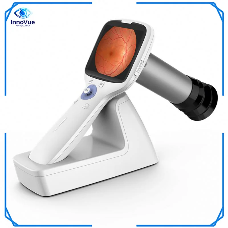 

Портативная фундус-камера InnoVue Opto HFC-100 для любых погодных условий с гарантией 1 год для работы в различных экологических условиях